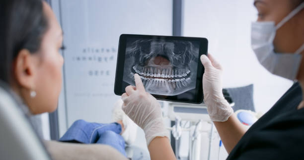 Licensed Teeth Whitening service in East Los Angeles, CA - Smile Center Dentistry